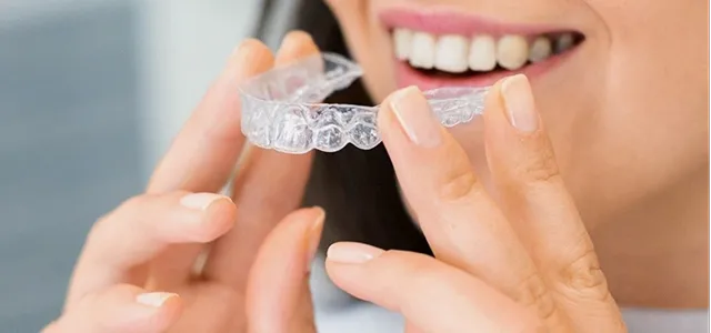 マウスピース矯正